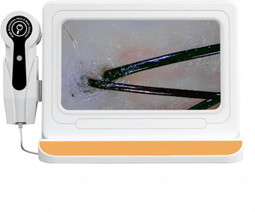 Scalp Analysis Device